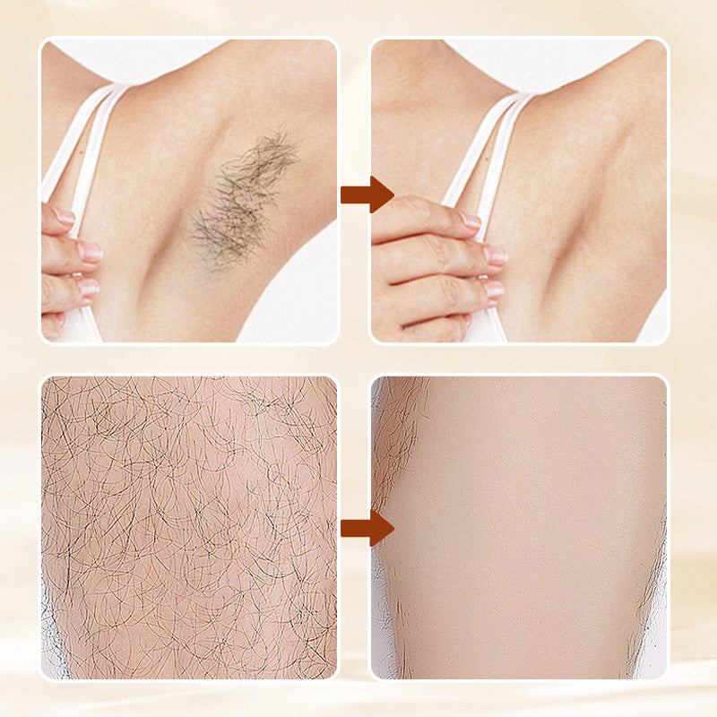 SilkiVive — Hair Removal Cream | 2+1 FREE