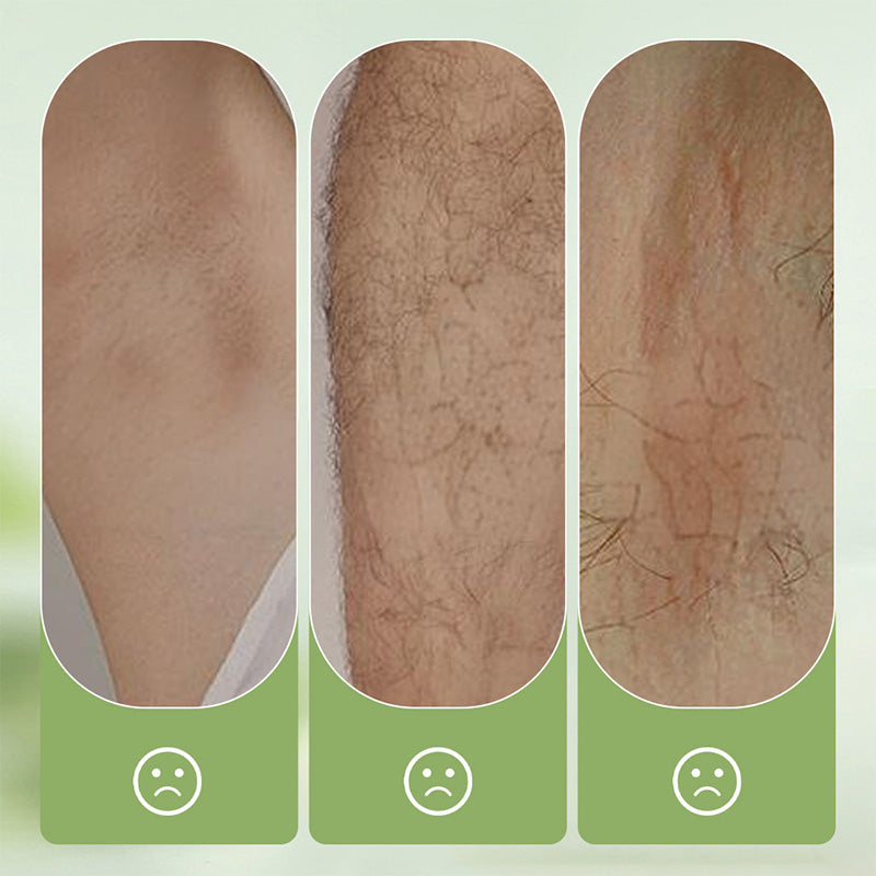SilkPure 8.8 oz — Gentle Hair Removal Cream | 1+1 FREE