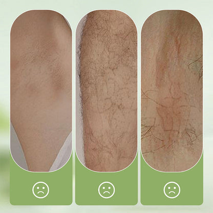 SilkPure 8.8 oz — Gentle Hair Removal Cream | 1+1 FREE