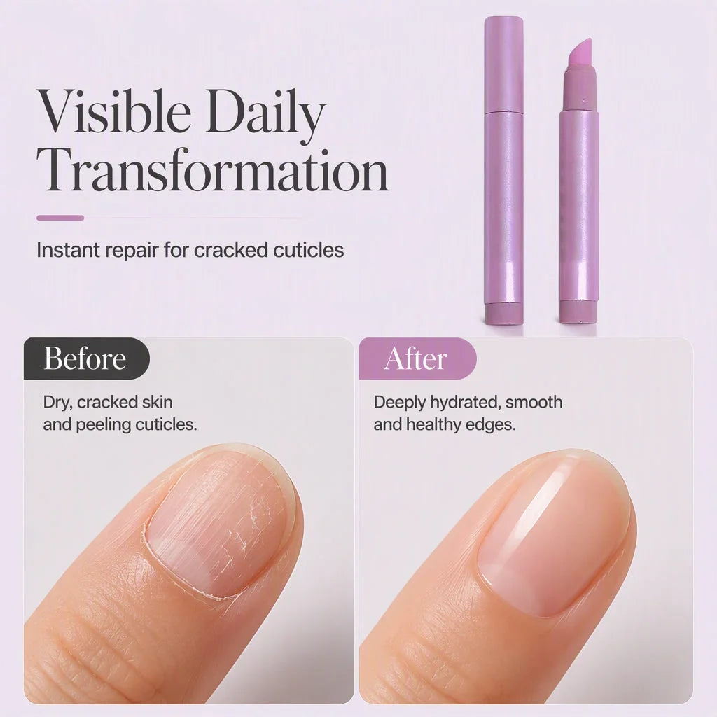 SilkNail Pen — Instant Softness Anywhere