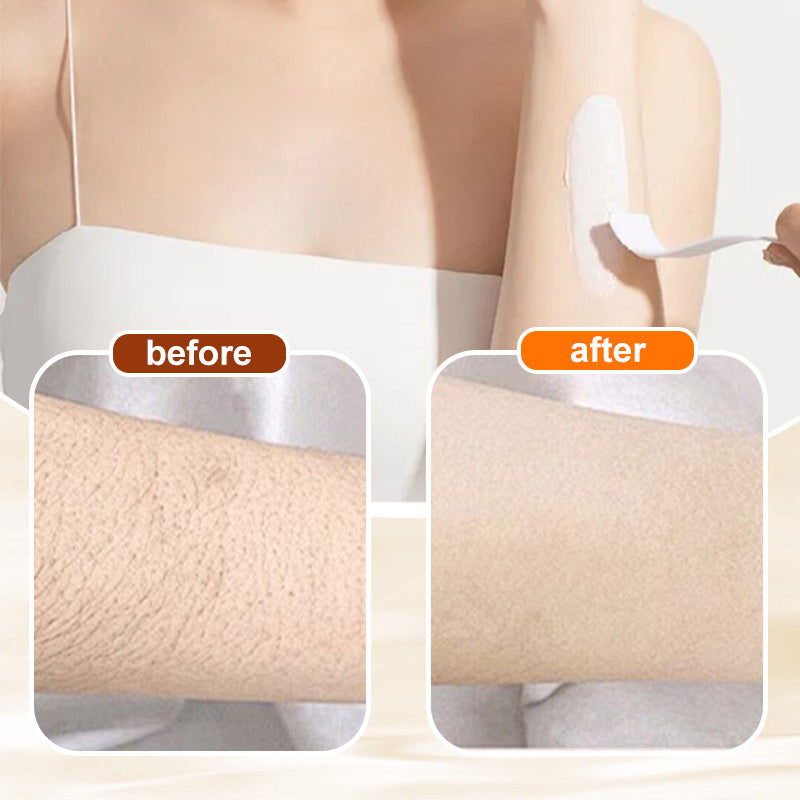 SilkiVive — Hair Removal Cream | 2+1 FREE