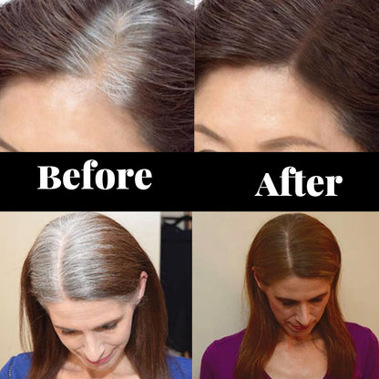 LumaRoot — Erase Gray Instantly