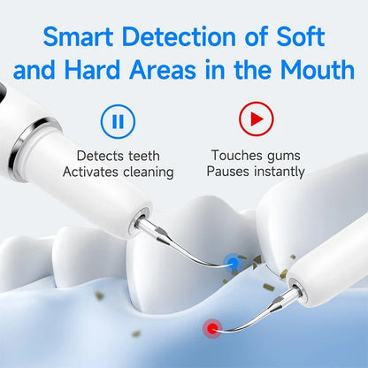 SmileSculpt — Effortless Deep Cleanse