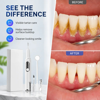 SmileSculpt — Effortless Deep Cleanse