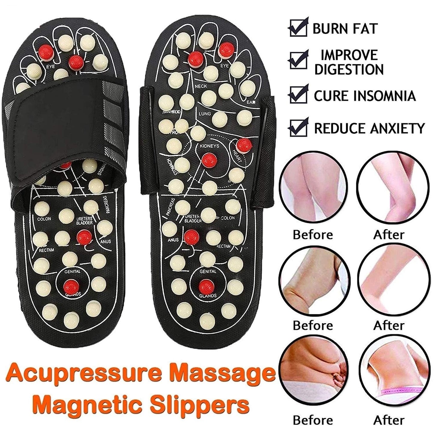 Acupressure Slippers — Pain Relief, Energy for Every Step