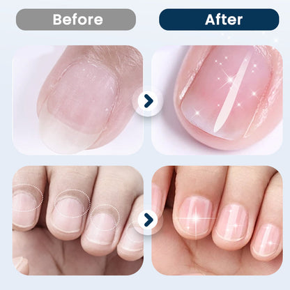 Nail Repair and Strengthening Spray — Hydrate, Strengthen, Shine
