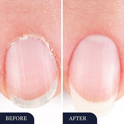 NailRevive Pen — Instant Strength Restoration