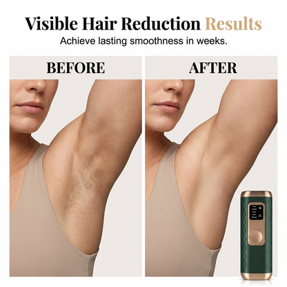 LuminaLuxe — Cooling IPL Device | 50% OFF