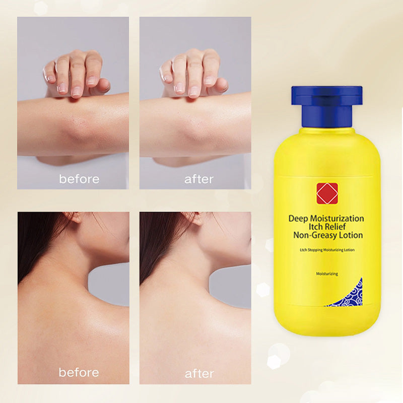 Dermaluxe Hydrating Relief — Instant Soothing, All-Day Comfort