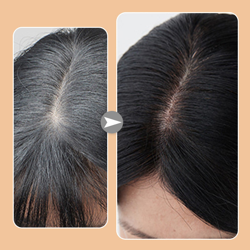 ShadeMist – Perfect Roots Anytime