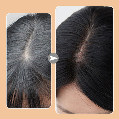 ShadeMist – Perfect Roots Anytime