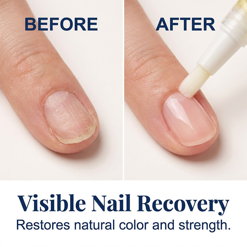 Nail Care Set – Strengthen, Shine, Impress