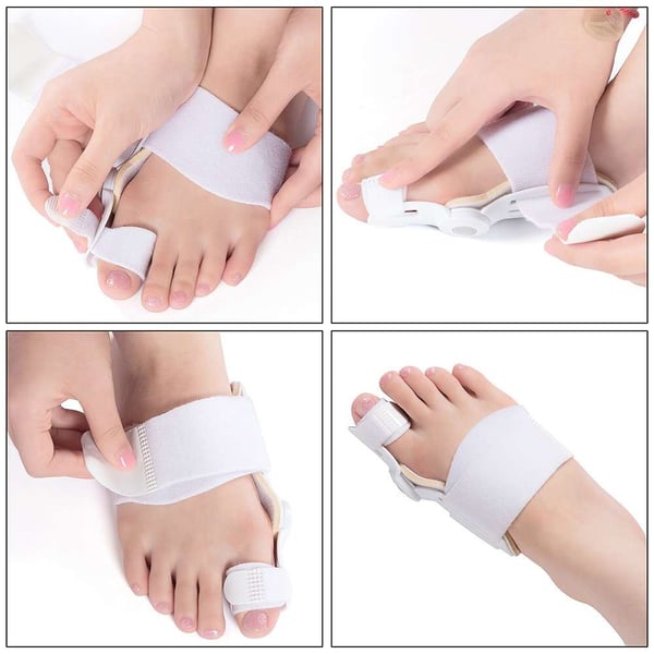 SoleAlign Hammertoe Solution – Daily Pain-Free Steps