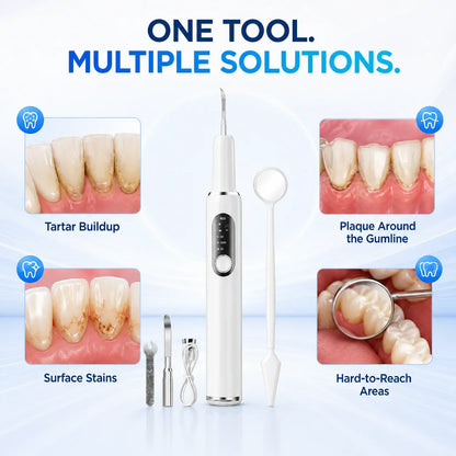 SmileSculpt — Effortless Deep Cleanse