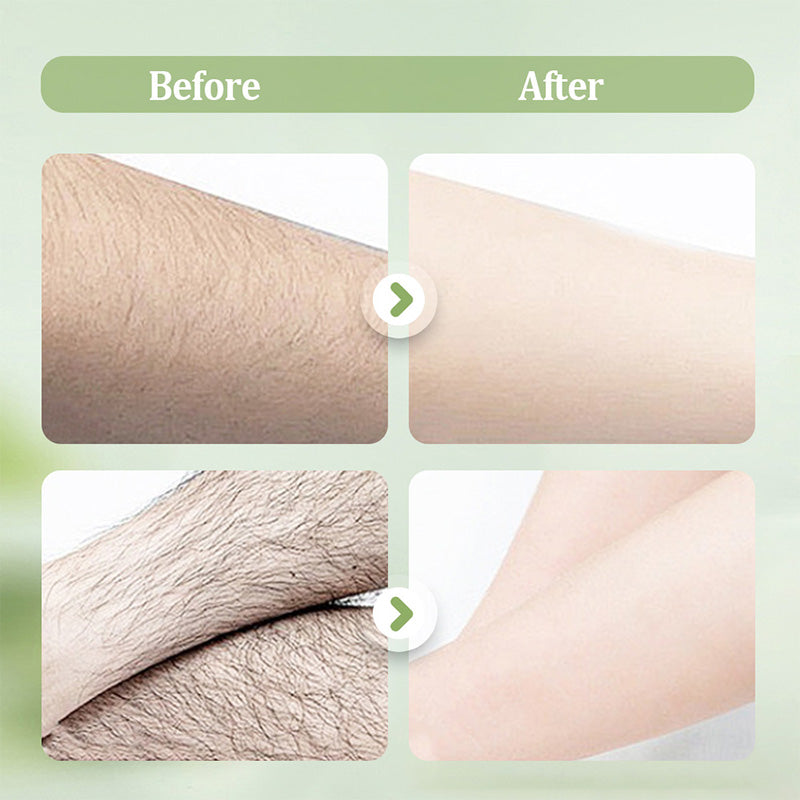 SilkPure 8.8 oz — Gentle Hair Removal Cream | 1+1 FREE