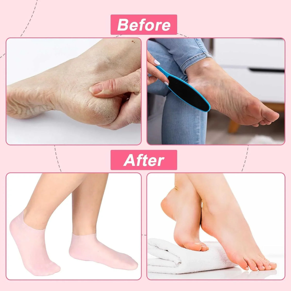 Silkura+ Moisture-Boost Socks — Heal, Hydrate, Renew