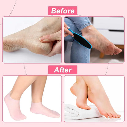 Silkura+ Moisture-Boost Socks — Heal, Hydrate, Renew