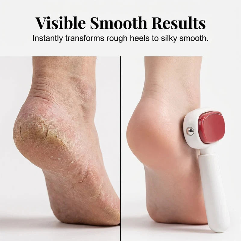 Dual-Sided Stainless Steel Foot File — Instantly Smooth, Pain-Free Heels