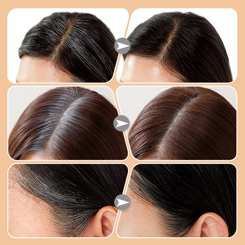ShadeMist – Perfect Roots Anytime