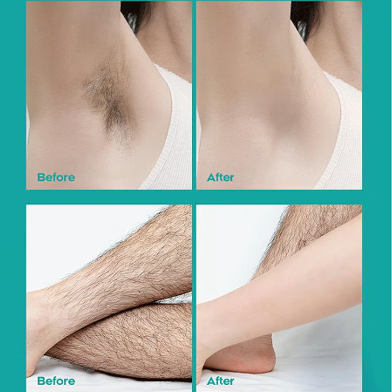 SilkenEase – Pain-Free Smoothness Forever | Buy 1 Get 1 Free