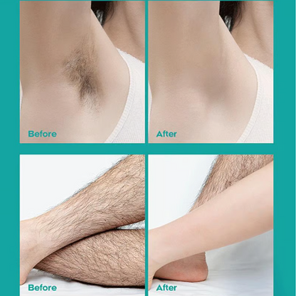 SilkenEase – Pain-Free Smoothness Forever | Buy 1 Get 1 Free
