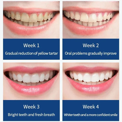 SX-502 Electric Toothbrush — Radiate Fresh Confidence