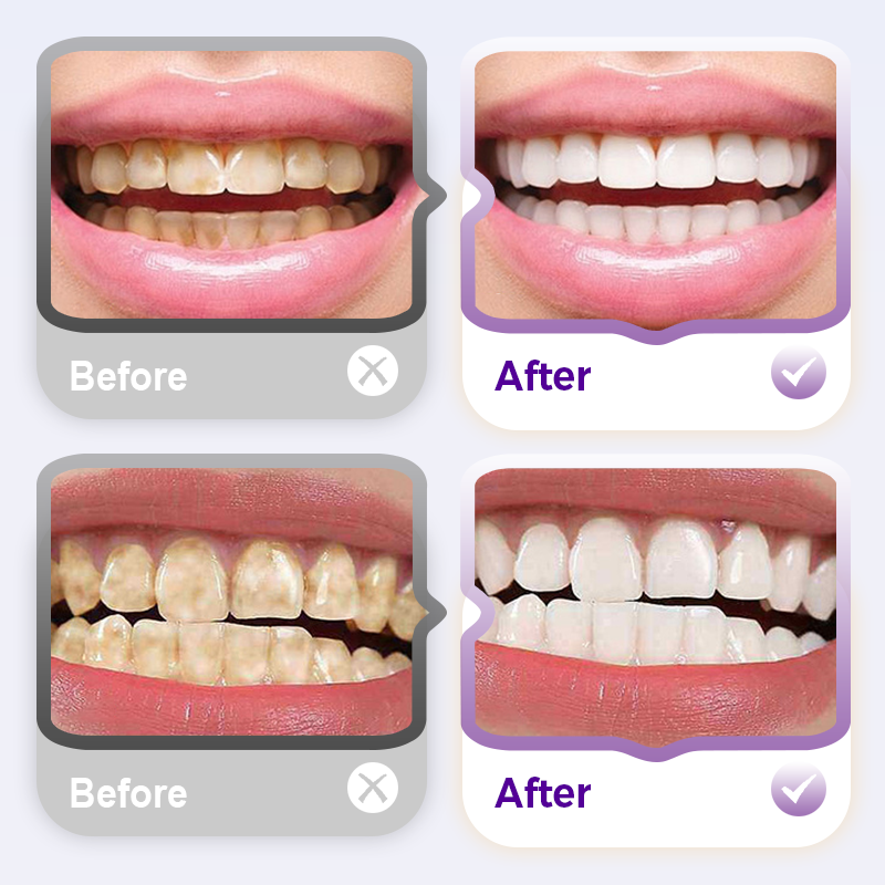 LumaPearl — Brighten Protect Refresh - 100g